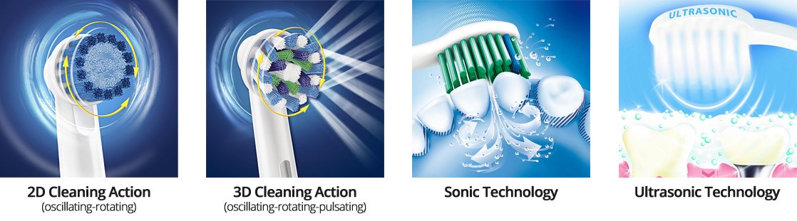 ETB types of action, electirc or manual toothbrush