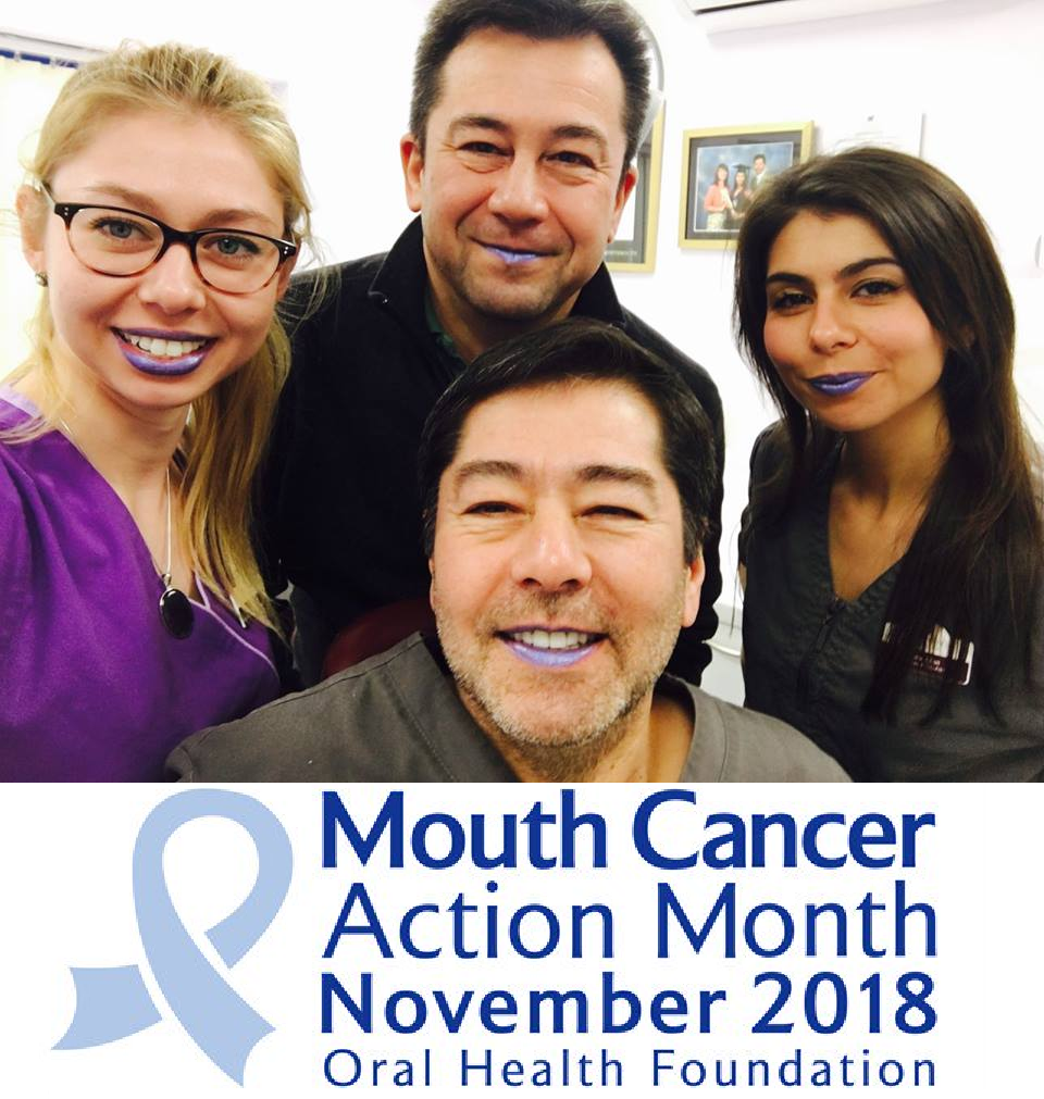 Blue lip selfie for mouth cancer awareness month at Andover dentist