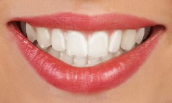 Clear Aligners available at New Street Dental Care