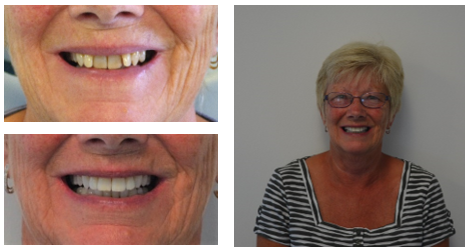Testimonial from M. Smith who was very happy with her treatment of braces